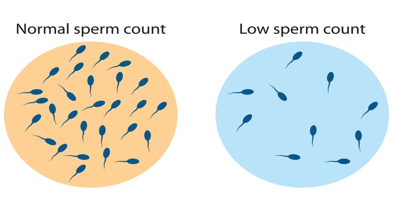 What-is-low-sperm-count