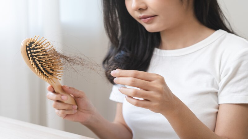 Postpartum hair fall