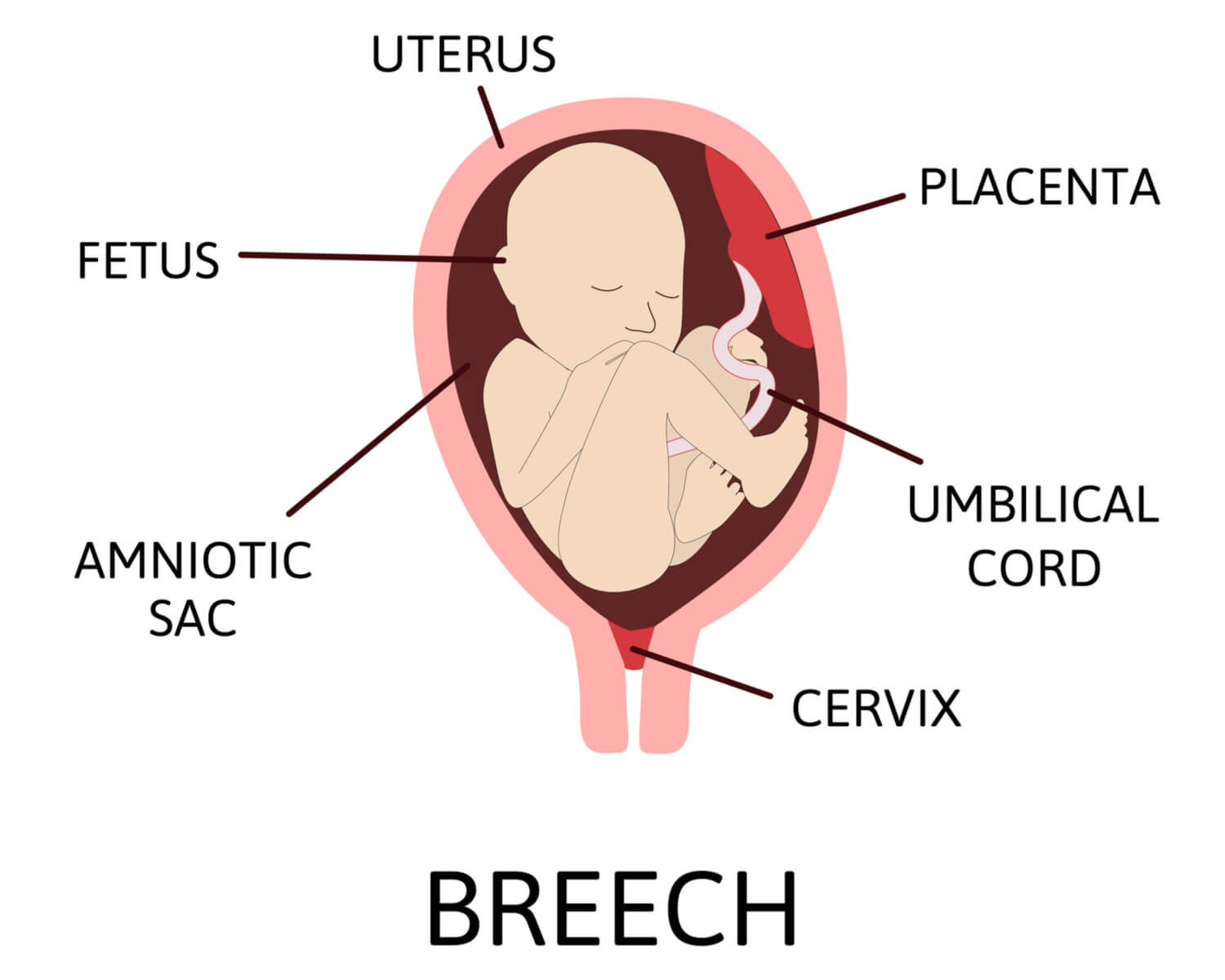 changing-a-breech-baby-s-position-being-the-parent