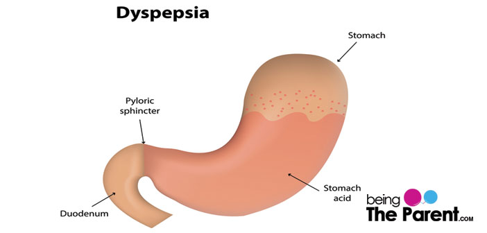 Indigestion During Pregnancy Causes Symptoms And Prevention Being 