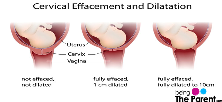 What Happens To Your Cervix During Birth Or Labor Being The Parent