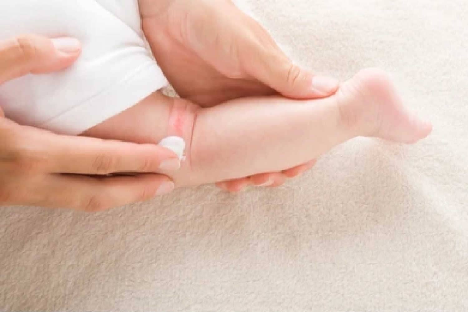 Fungal Skin Infections In Babies Causes Symptoms And Treatment 