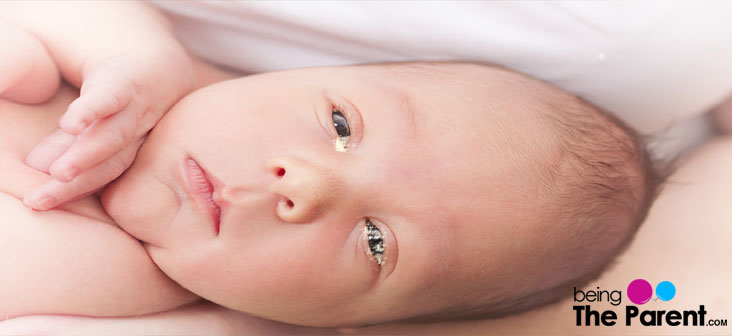 What Is Sticky Eye In Babies