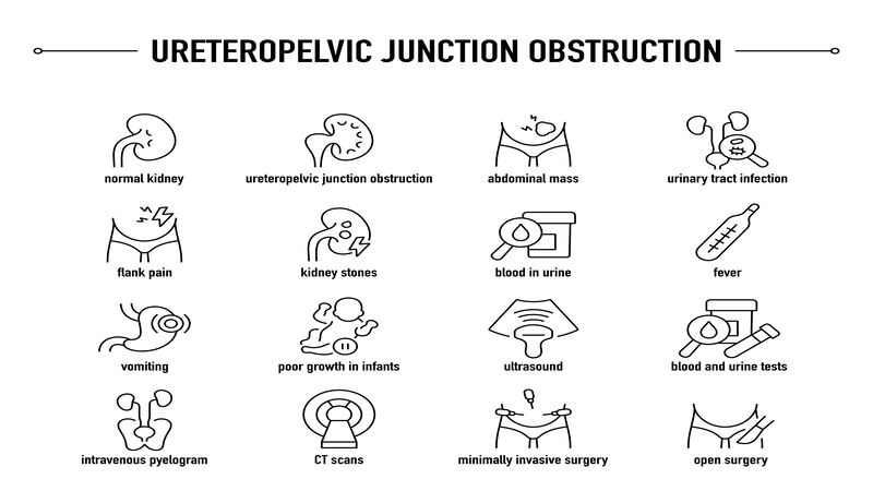 Ureteropelvic junction obstruction (UPJ)