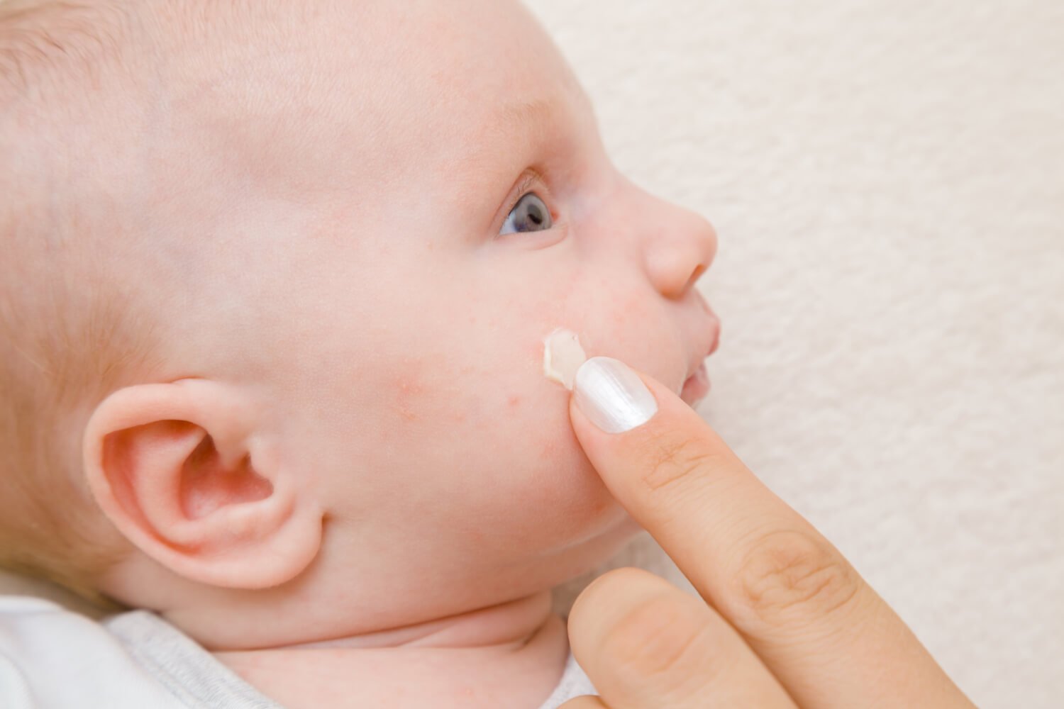 boils-on-babies-causes-symptoms-and-treatments-being-the-parent