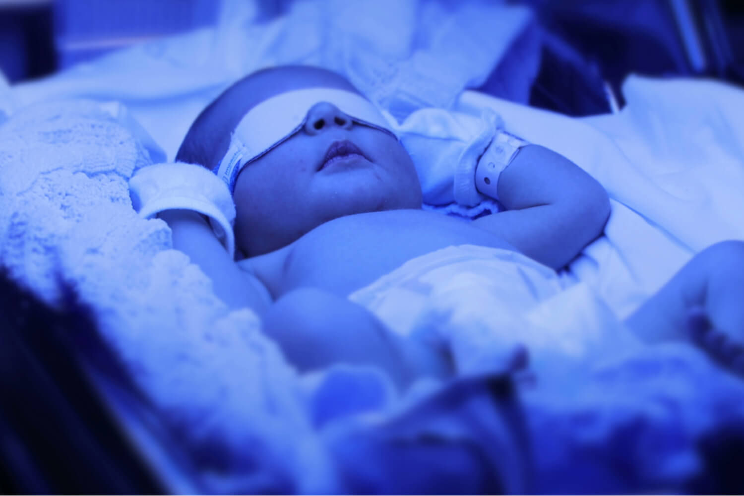 Новорожденный мальчик под лампой
