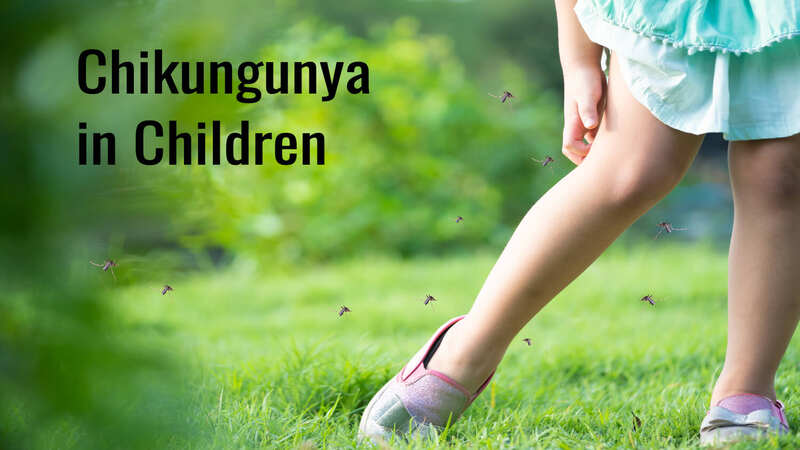 Chikungunya-in-children