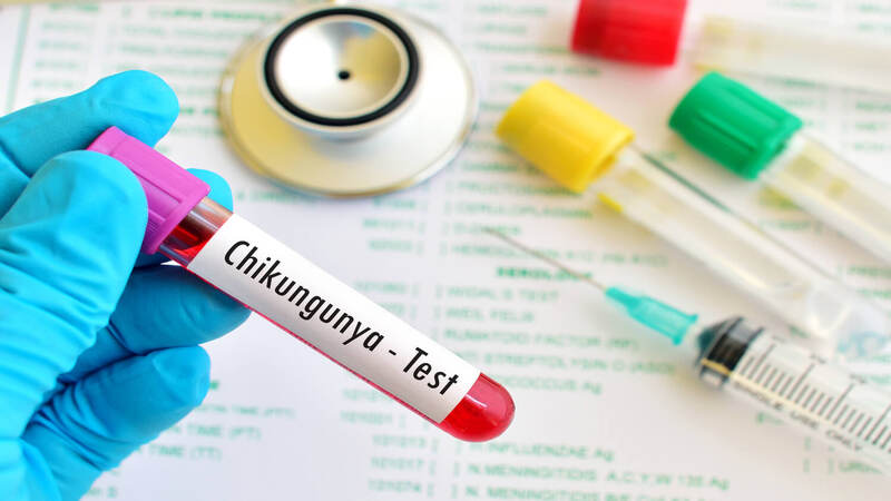 Chikungunya-test-