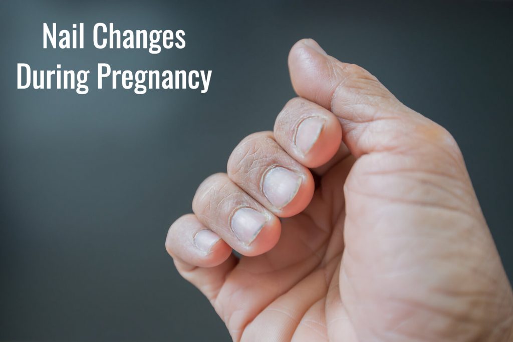 nail-changes-during-pregnancy-causes-and-treatment-being-the-parent