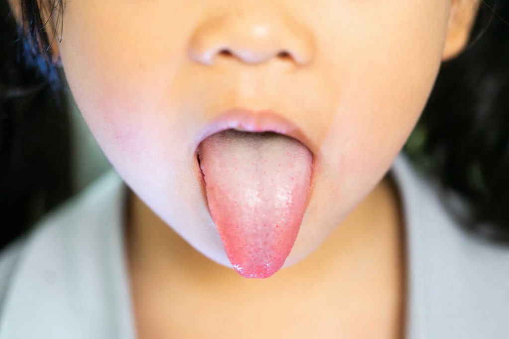 bad-breath-in-toddlers-causes-home-remedies-and-tips-to-deal-with