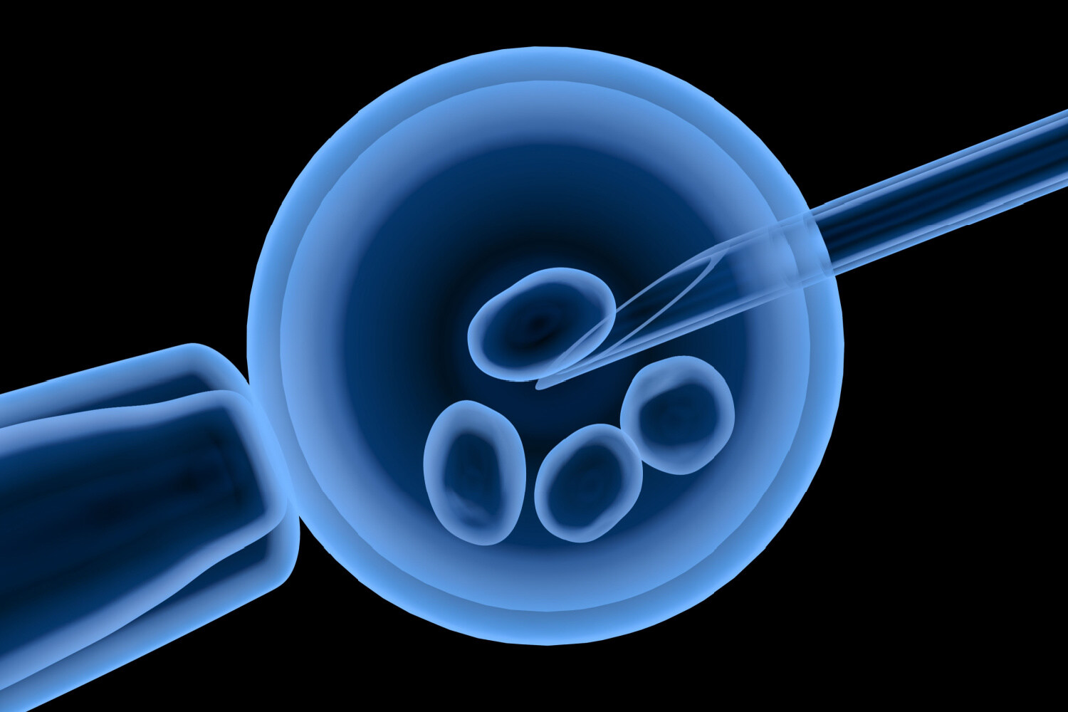 Top IVF Centers India