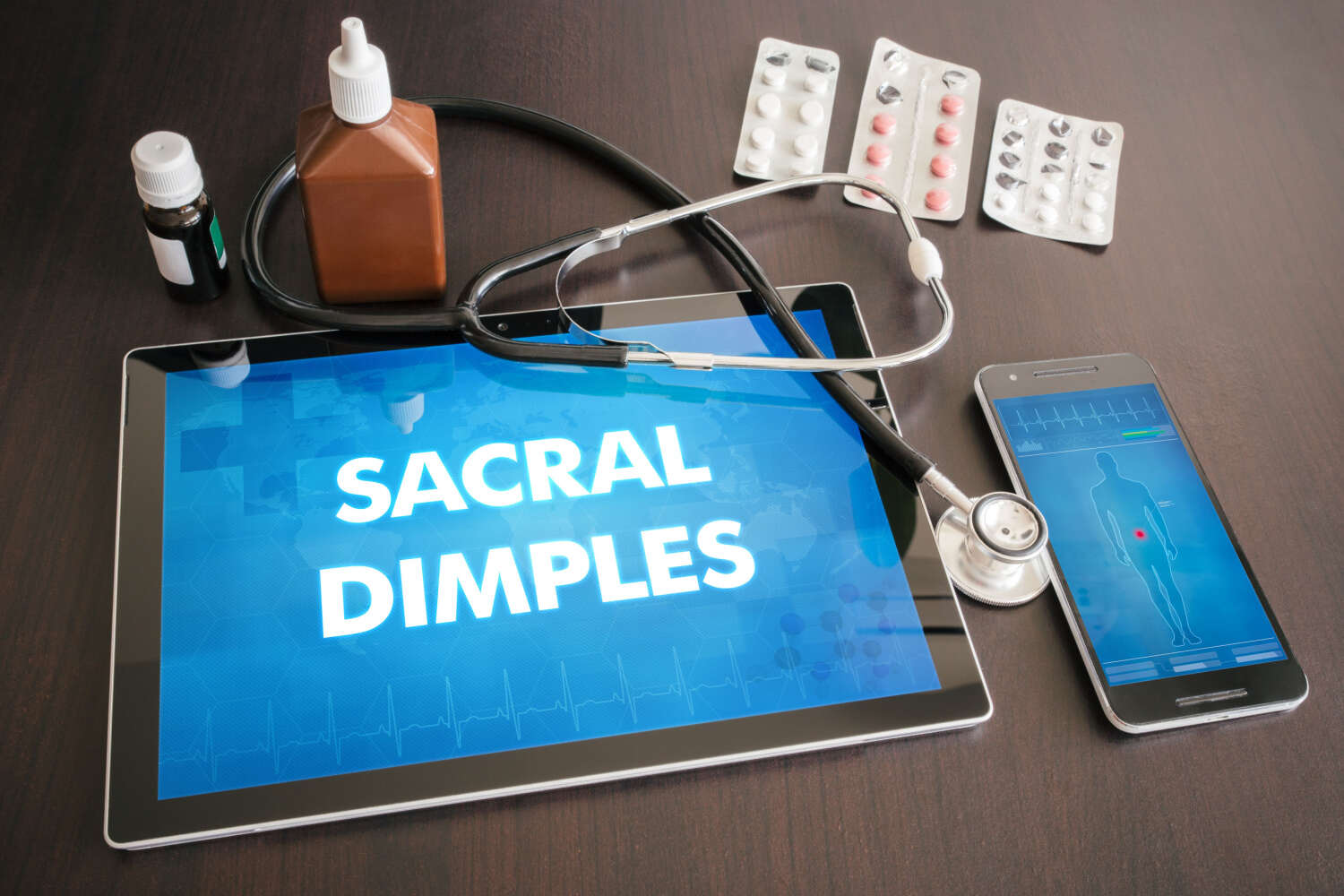 Sacral Dimples in Newborns - What is it, Types and Complications ...