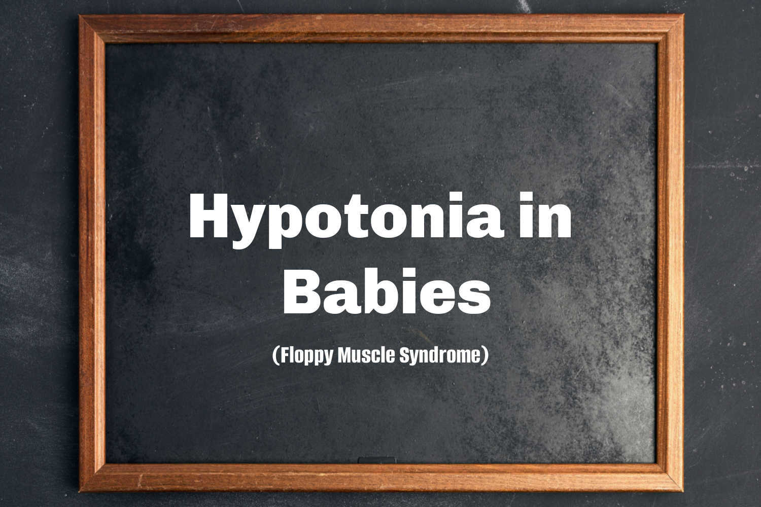 How To Diagnose Hypotonia In Babies