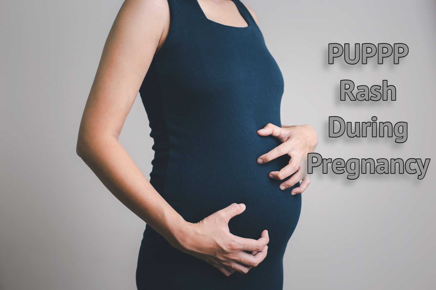 Puppp Rash During Pregnancy Causes Symptoms And Treatment Being The