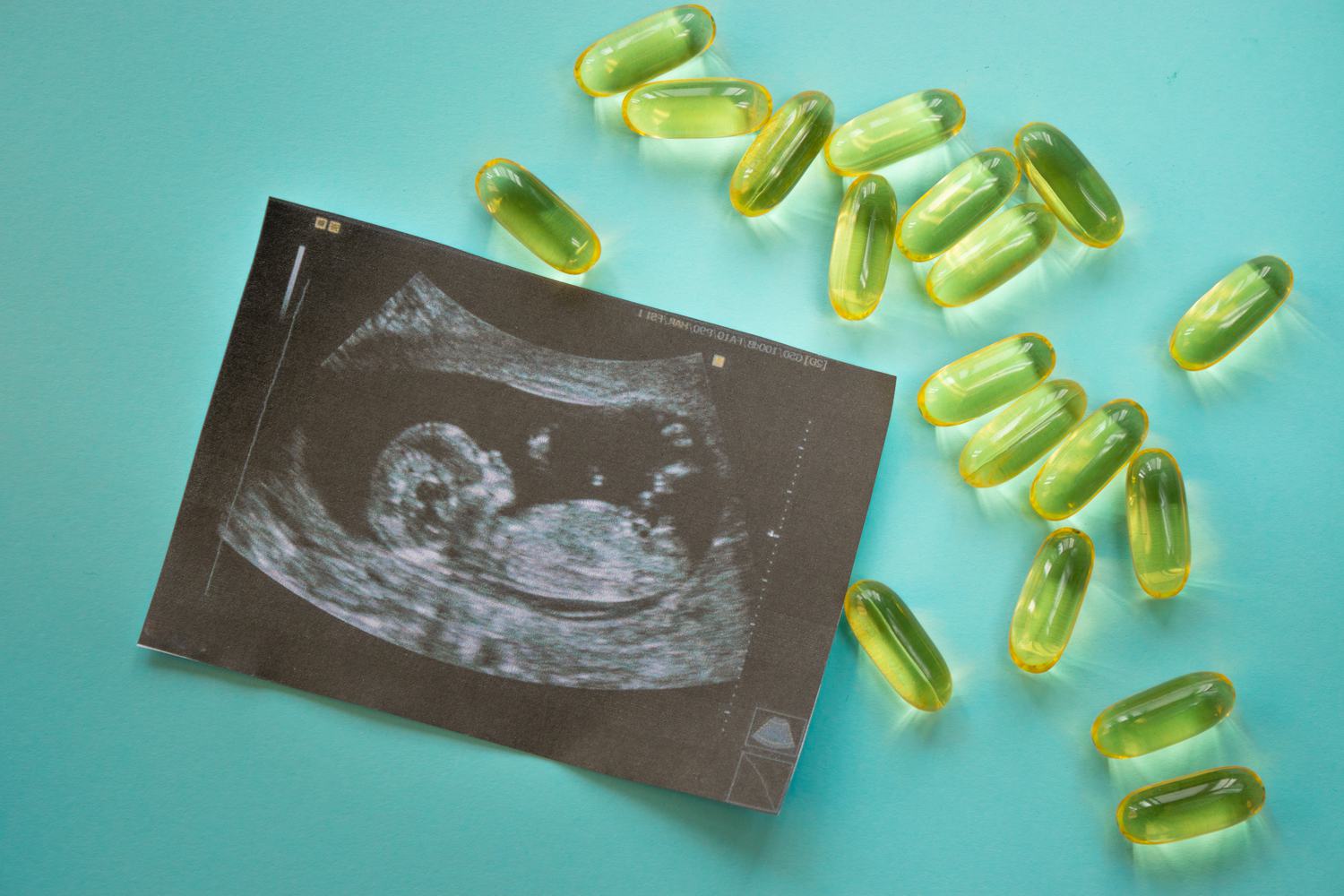 vitamin-e-during-pregnancy-being-the-parent