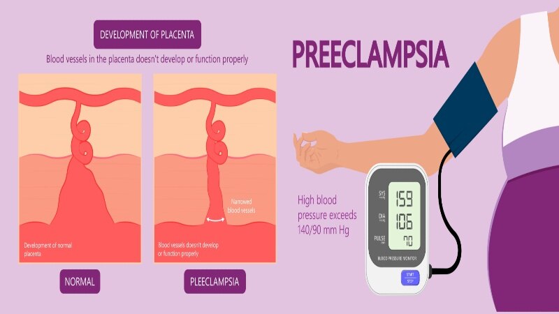 Causes of High AFP Levels In Pregnancy_