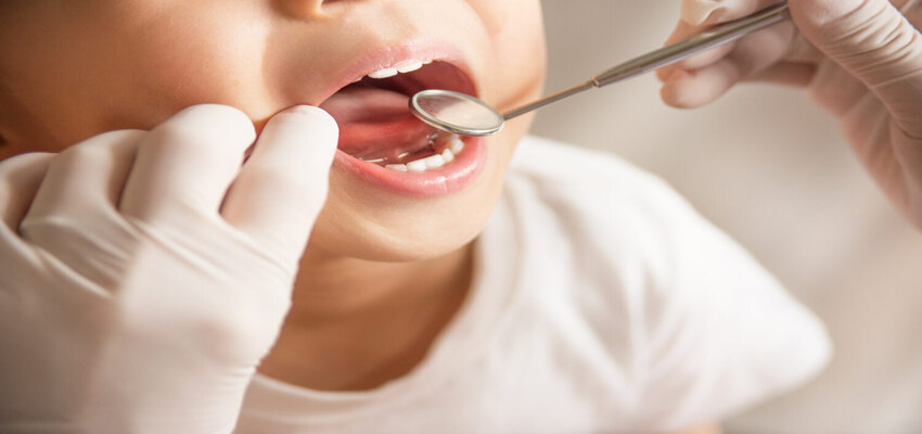 Does Your Toddler Require Root Canal?