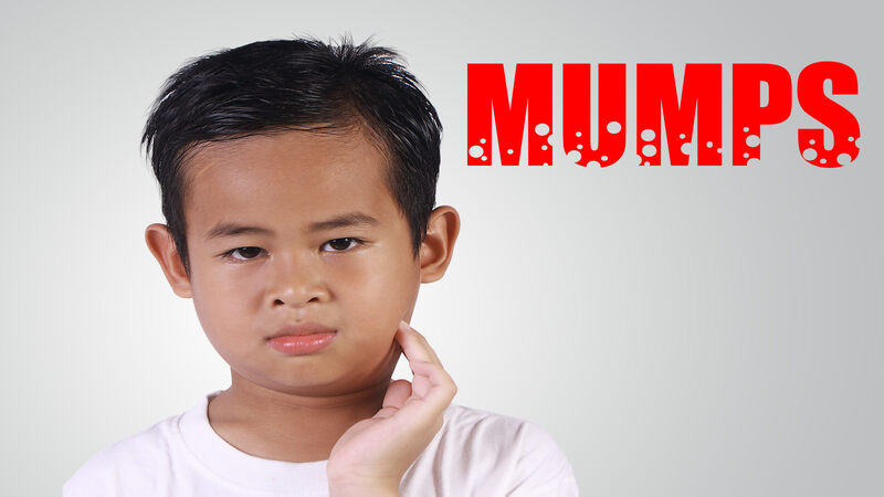 Mumps in children