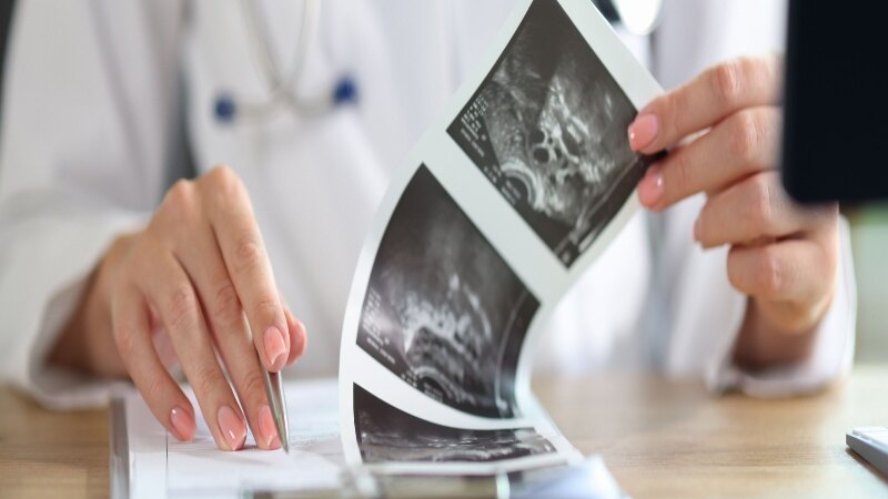 How to Read an Ultrasound Report of Pregnancy_