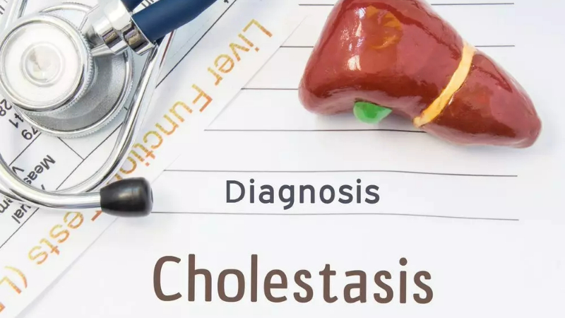 cholestasis