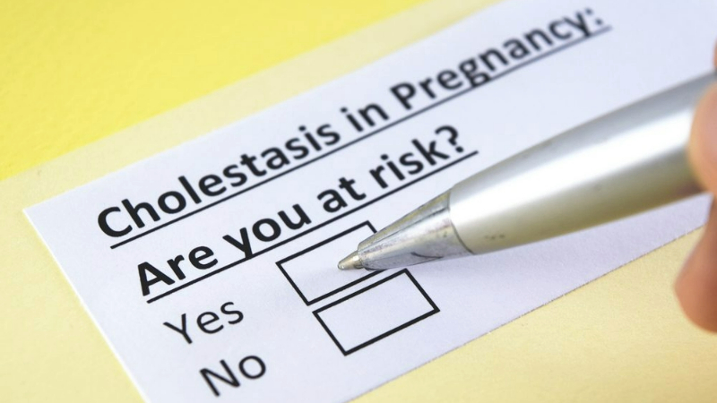 cholestasis of pregnancy