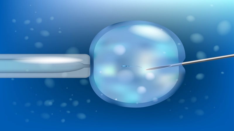 IVF for infertility