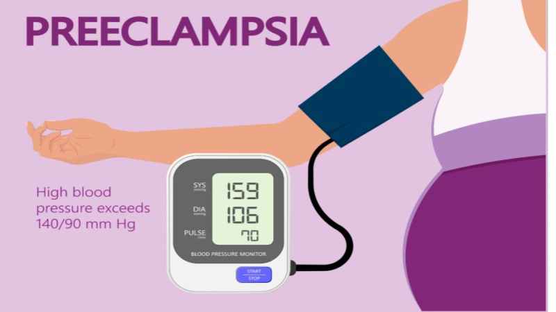 Preeclampsia inforgraphics