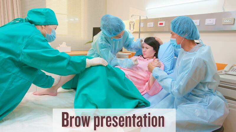 What Is Brow Presentation_ What Are Its Complications_