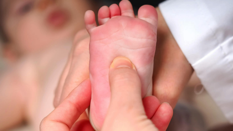 doctor checking babinski reflex baby