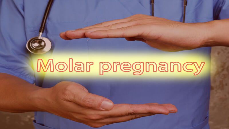 Molar Pregnancy