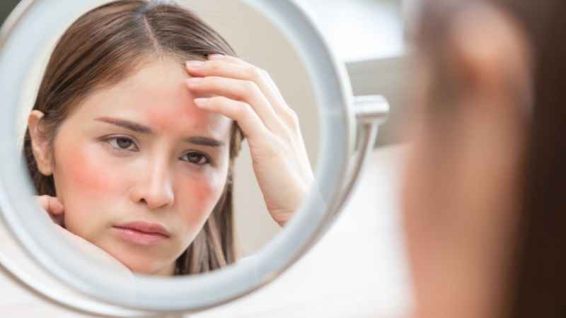 women checking her skin rash