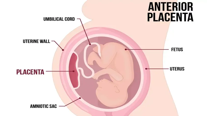 Anterior-placenta