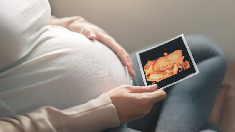 What Is a 3D_4D Scan During Pregnancy_