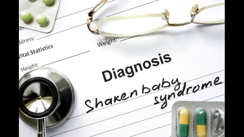 Diagnosing shaken-baby-syndrome