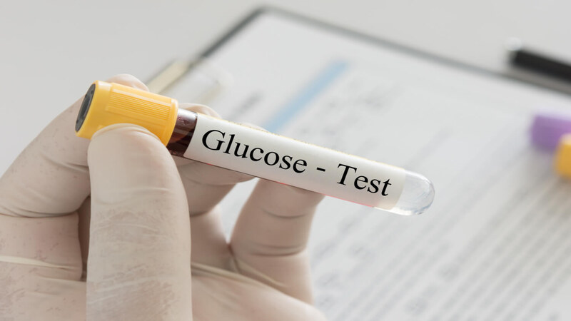 glucose-test